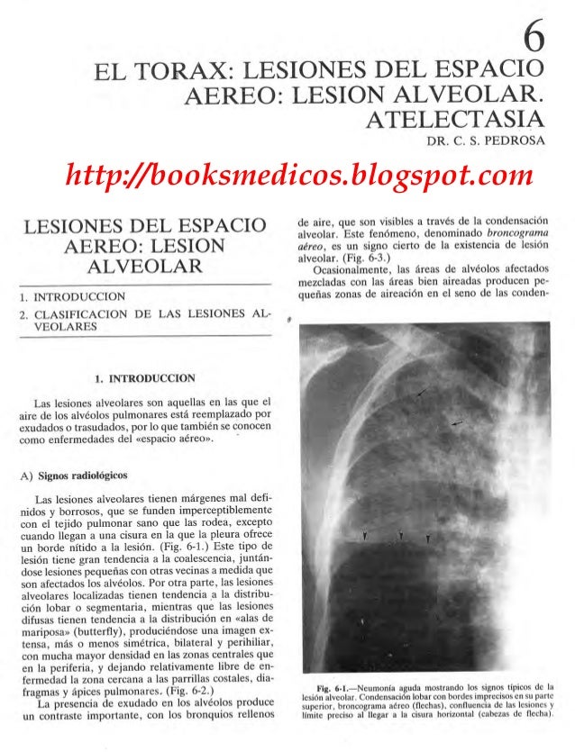 compendio de imagenologia pedrosa